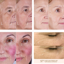 Heated and vibrating facial massager, scraper, facial lifting and slimming tool