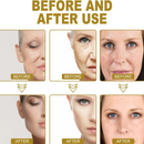 Facial mask with electric vibration facial beauty massager for skin rejuvenation and anti-wrinkle