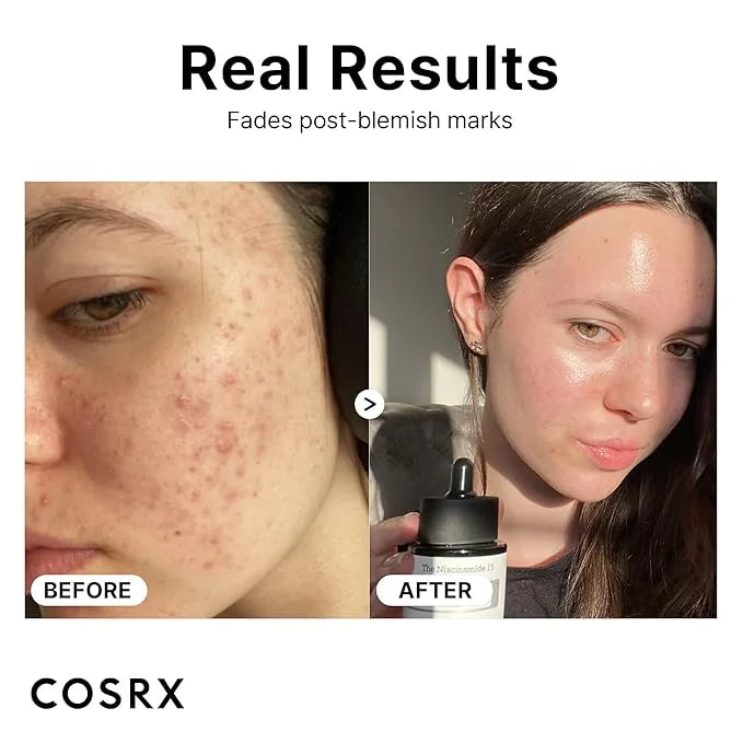Cosrx Niacinamide 15% Face Serum 20 Ml