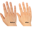 Targets your hands and your age, LED mask for wrinkled, damaged, and dry hands